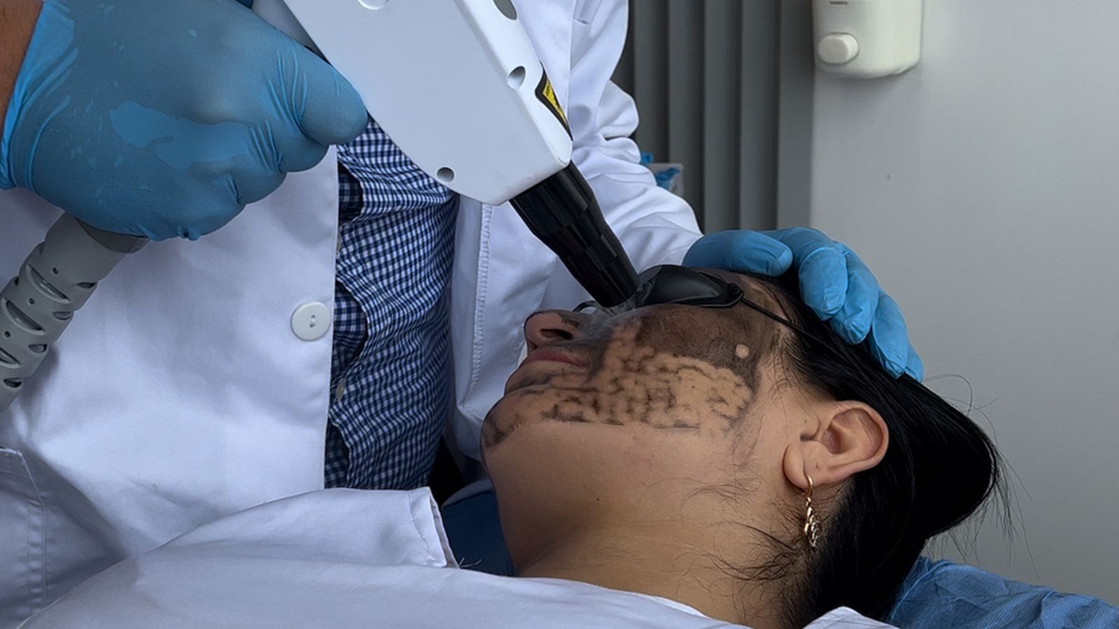 Hollywood Peel