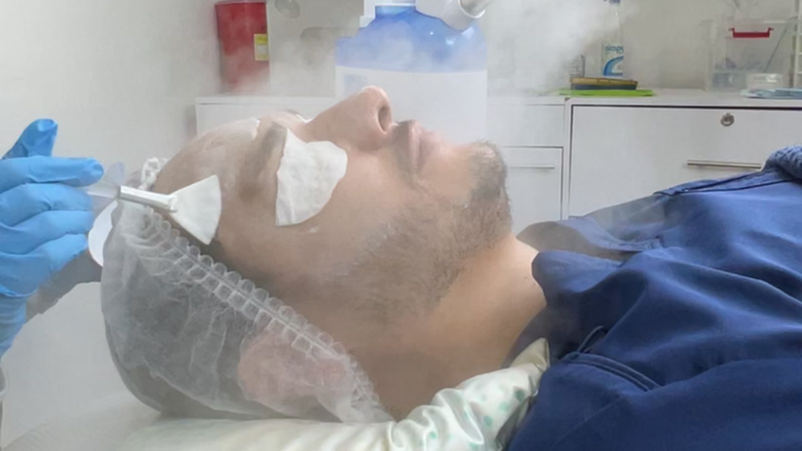 Limpieza facial