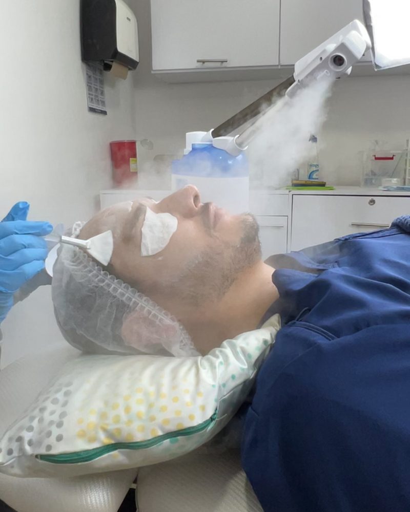 Limpieza facial