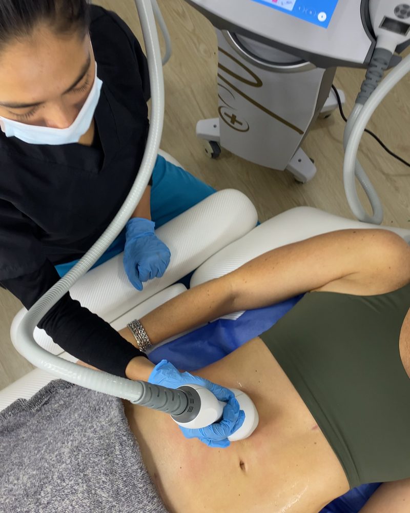 Mesoterapia corporal