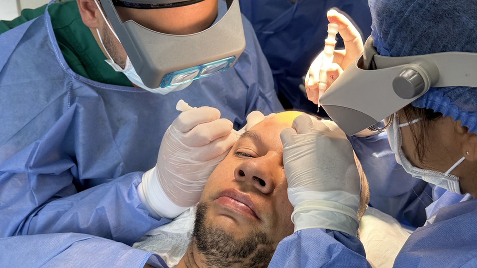 Trasplante de barba