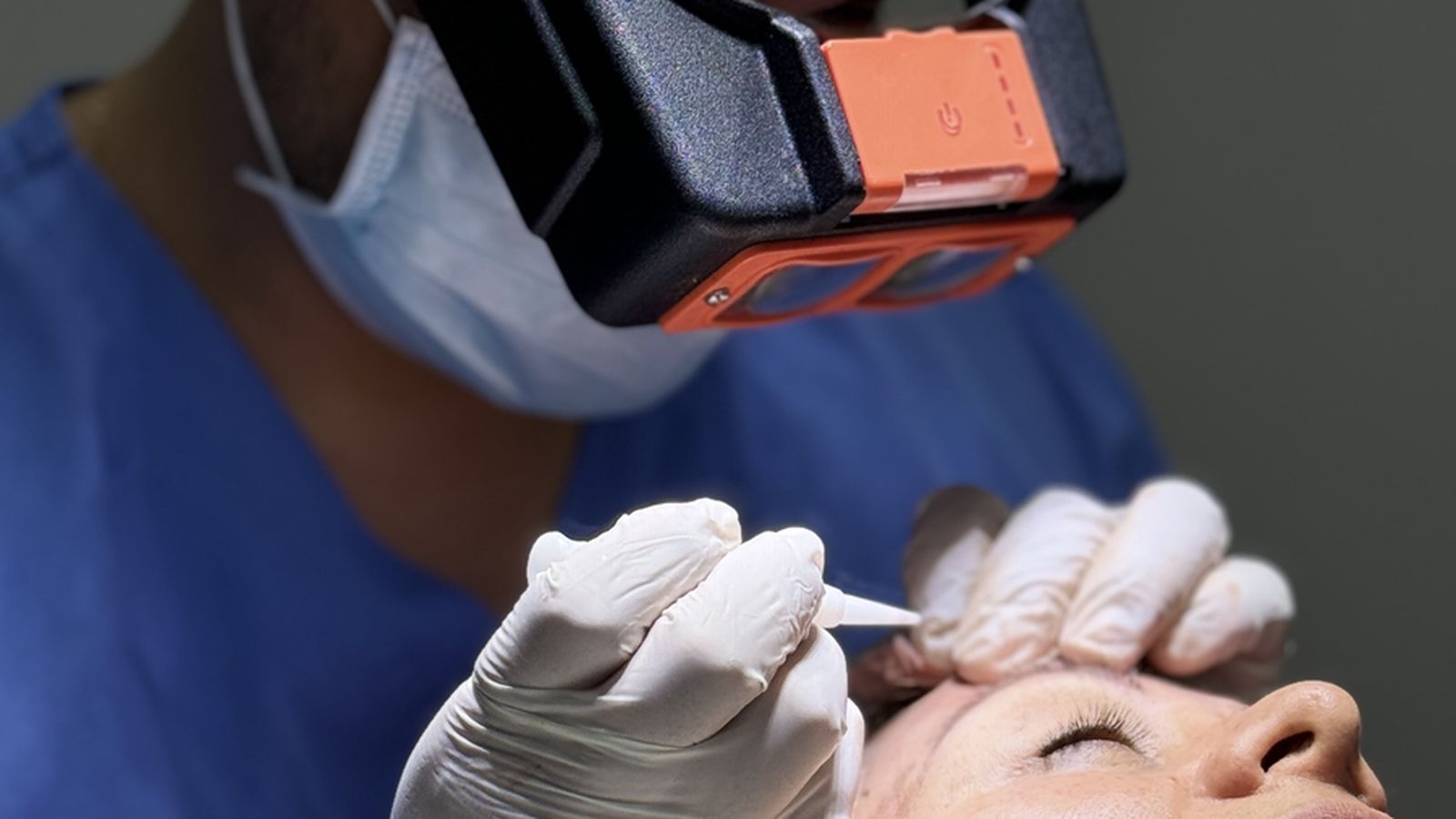 Trasplante de cejas