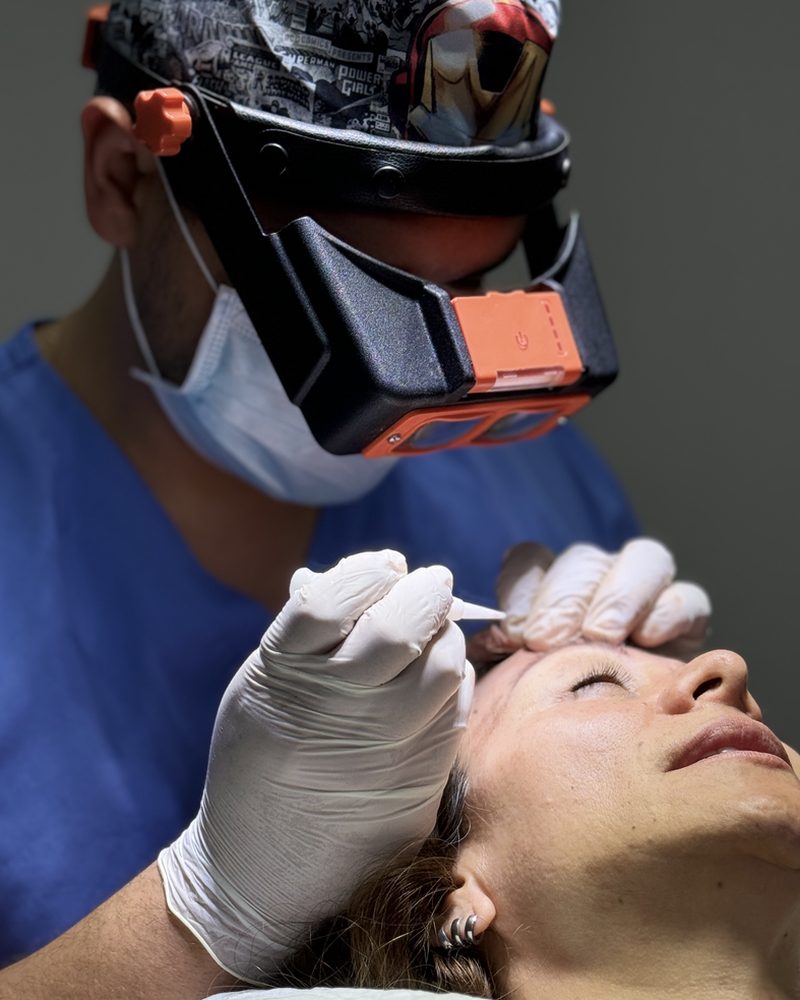 Trasplante de cejas